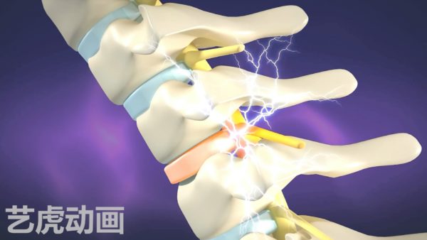 醫(yī)學動畫制作