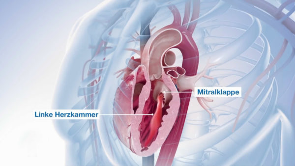 醫(yī)學三維動畫制作