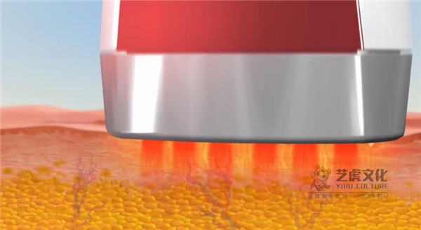 醫(yī)學(xué)動(dòng)畫(huà)公司設(shè)計(jì)