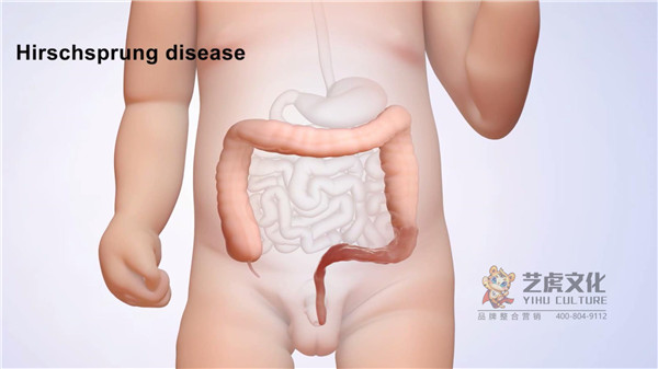 醫(yī)學(xué)動(dòng)畫(huà)公司制作